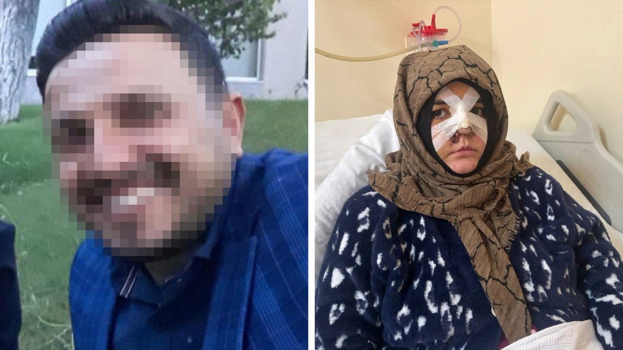 Kocası öldüresiye darp etti: ”Hapisten çıkarsa yarım bıraktığı işi tamamlayacak"