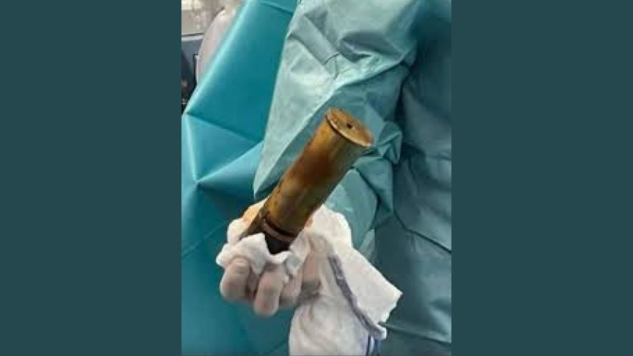 Makatından 1. Dünya Savaşı'ndan kalma mühimmat çıktı