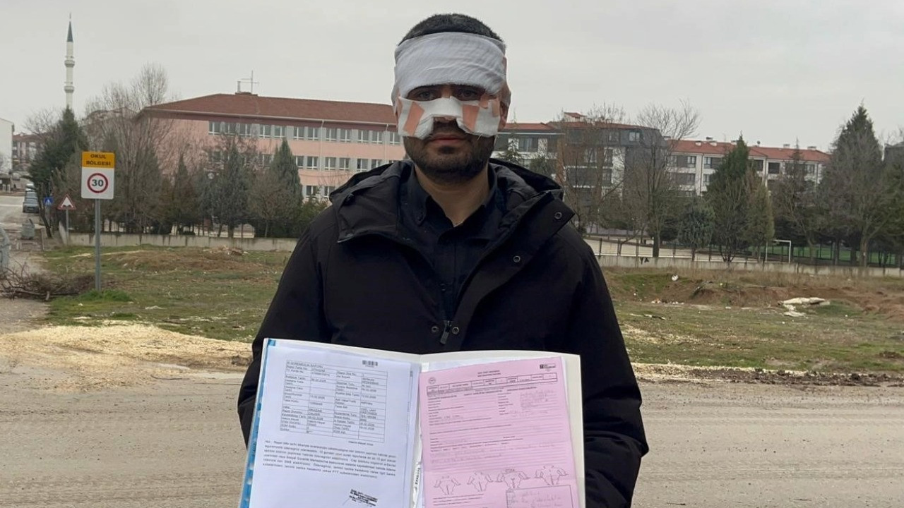 Rehber öğretmen fizik öğretmenini sıcak çayla haşladı