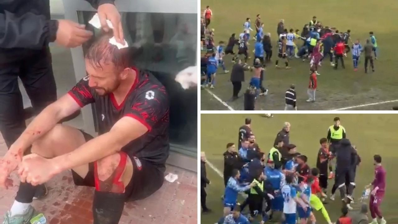 Amatör maçta kan gövdeyi götürdü: 3 yaralı