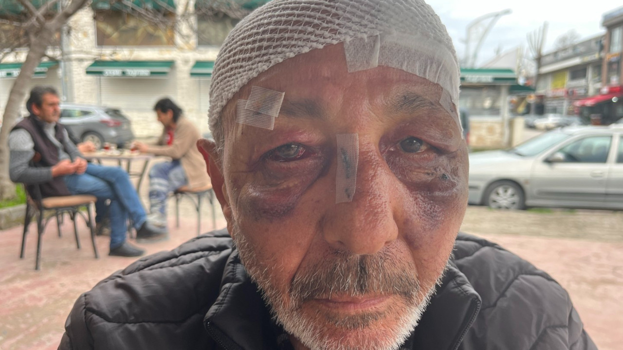 67 yaşında: Çakmak istediler verdi, bu hale geldi