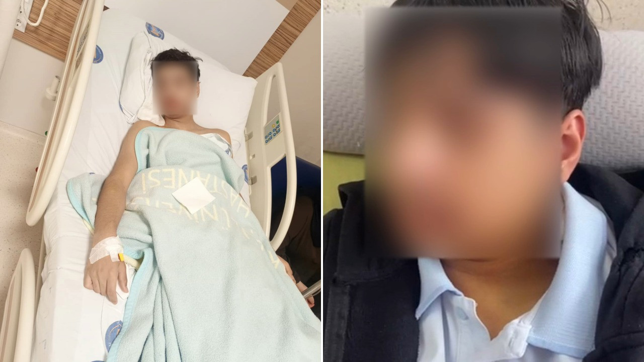 Liselerde işler çığrından çıkıyor: 'Kalkar mısın' dediği için çenesini kırdı