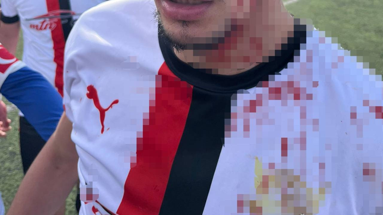 Maç bitiminde ortalık savaş alanına döndü: 3 futbolcu hastanelik oldu