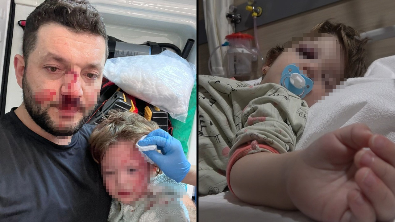 Türkiye'nin konuştuğu olayı anlattı: Bilerek yapmadık