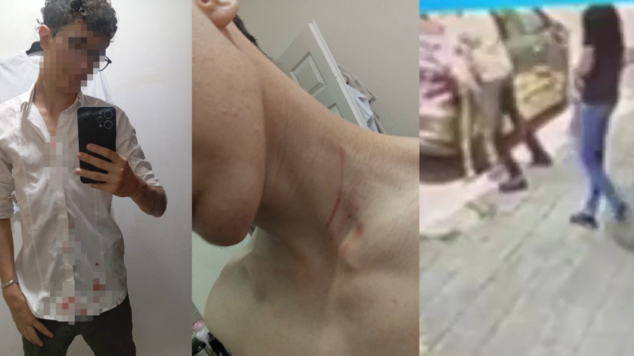 16 yaşındaki çocuğu sokak ortasında dövmüşlerdi! Verilen ceza tepki çekti