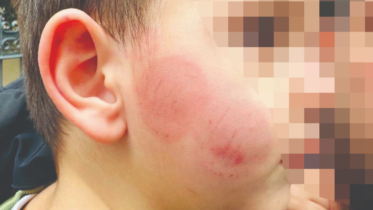 3 yaşındaki çocuğa kreşte korkunç darp