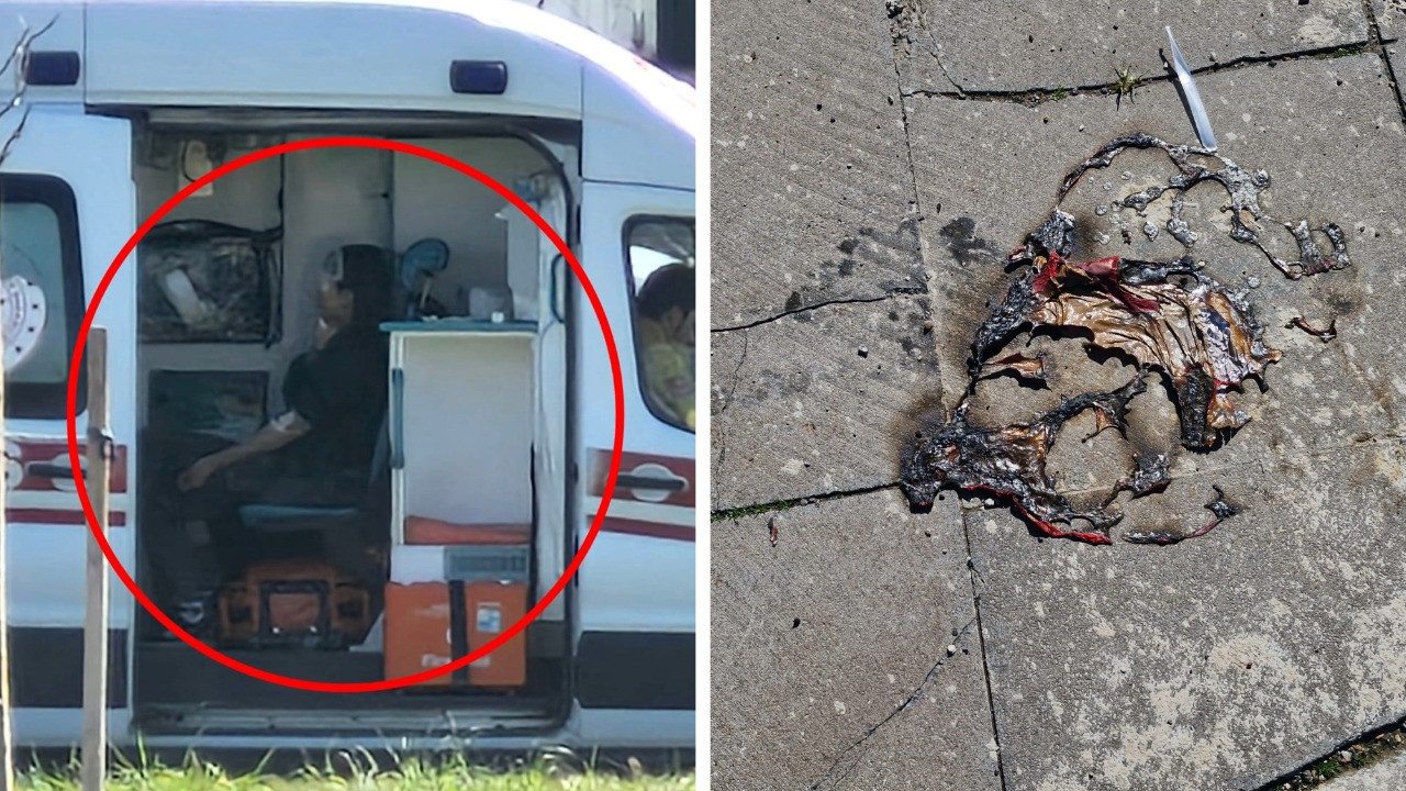 Helyum balonuyla oyun kötü bitti: 2 çocuk yaralandı