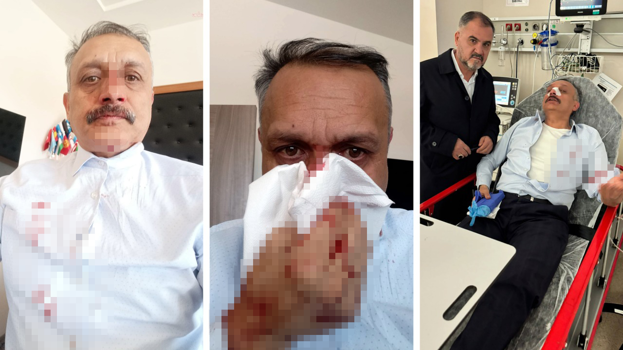 Okul müdürü, öğrencinin ağabeyi tarafından darbedildi