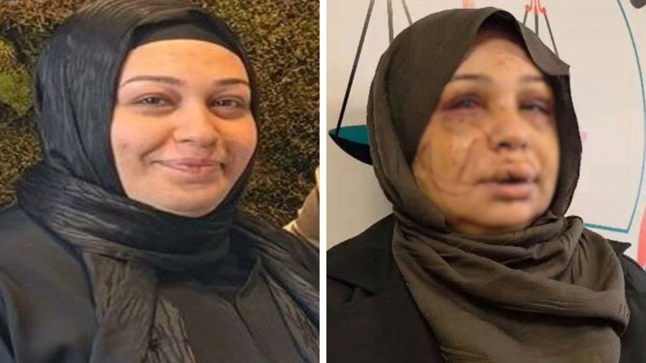 Eşini yaralayan polis memurunun davasında dikkat çeken karar