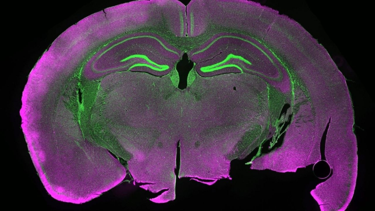 Fare beyin dokusunu dondurdular, çözüldüğünde ortaya çıkan sonuç şaşırttı