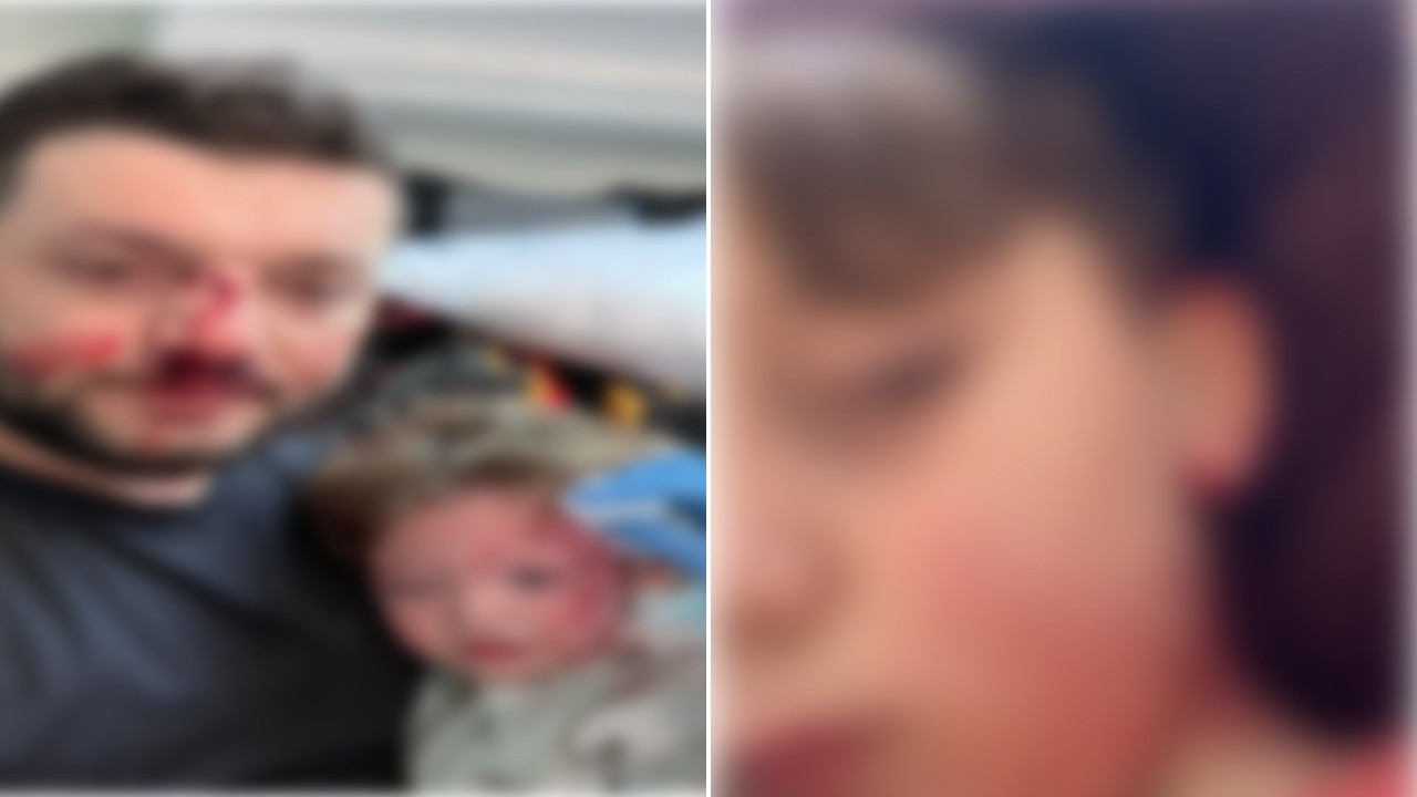 Önce babayı kucağında bebeğiyle dövdüler, şimdi de oğluna taşla saldırdılar