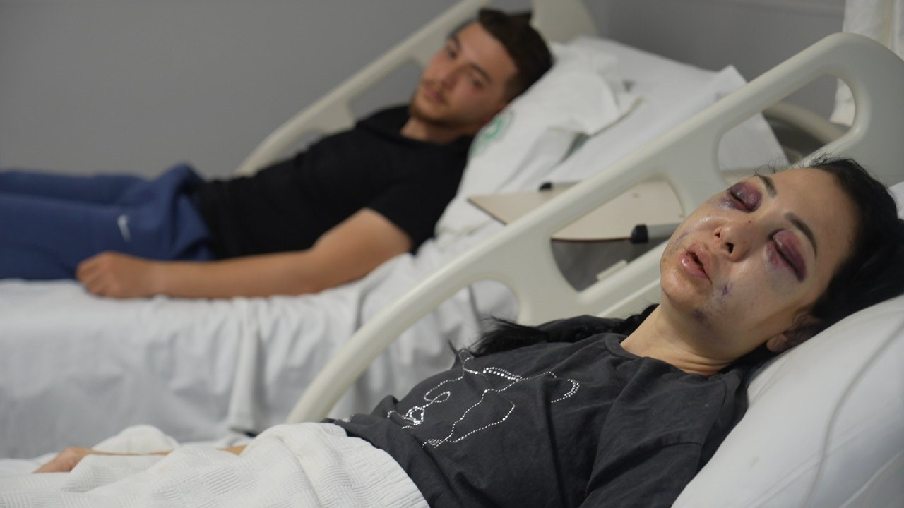 Anne ve oğluna kafede saldırdılar: Yüzü tanınmayacak halde