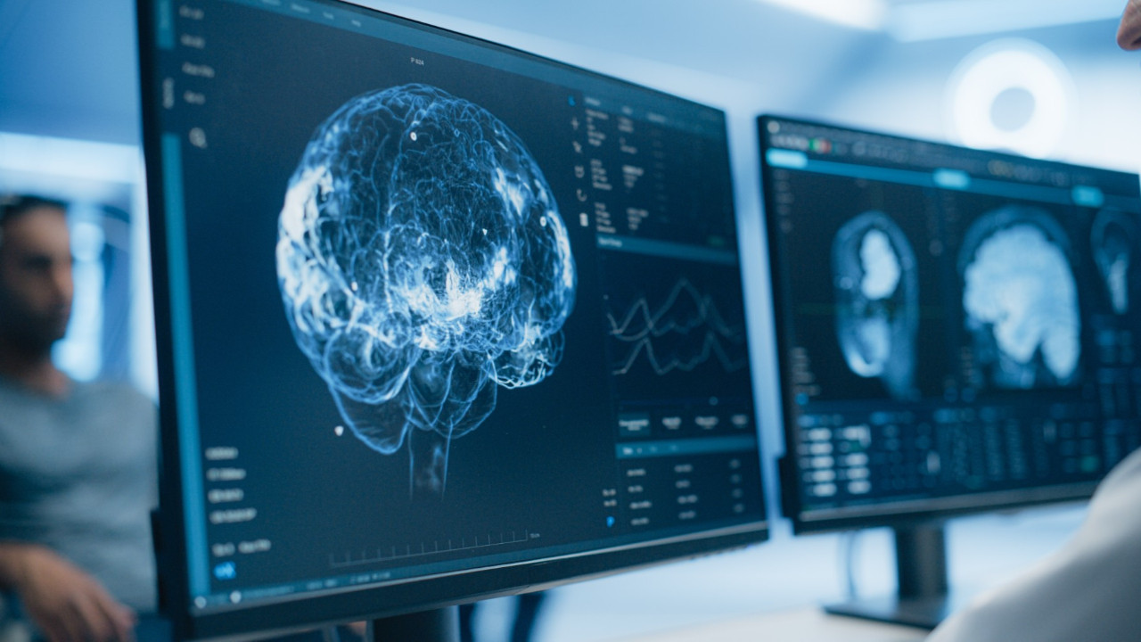 Bilim insanları yüksek tansiyonun beyindeki kaynağını ortaya çıkardı