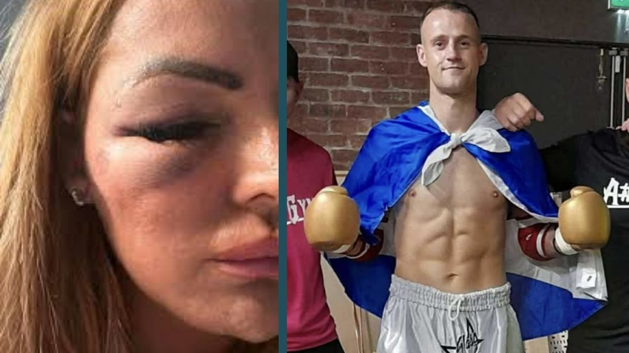 Kafes dövüşçüsü, kendisini reddeden kadını hastanelik etti