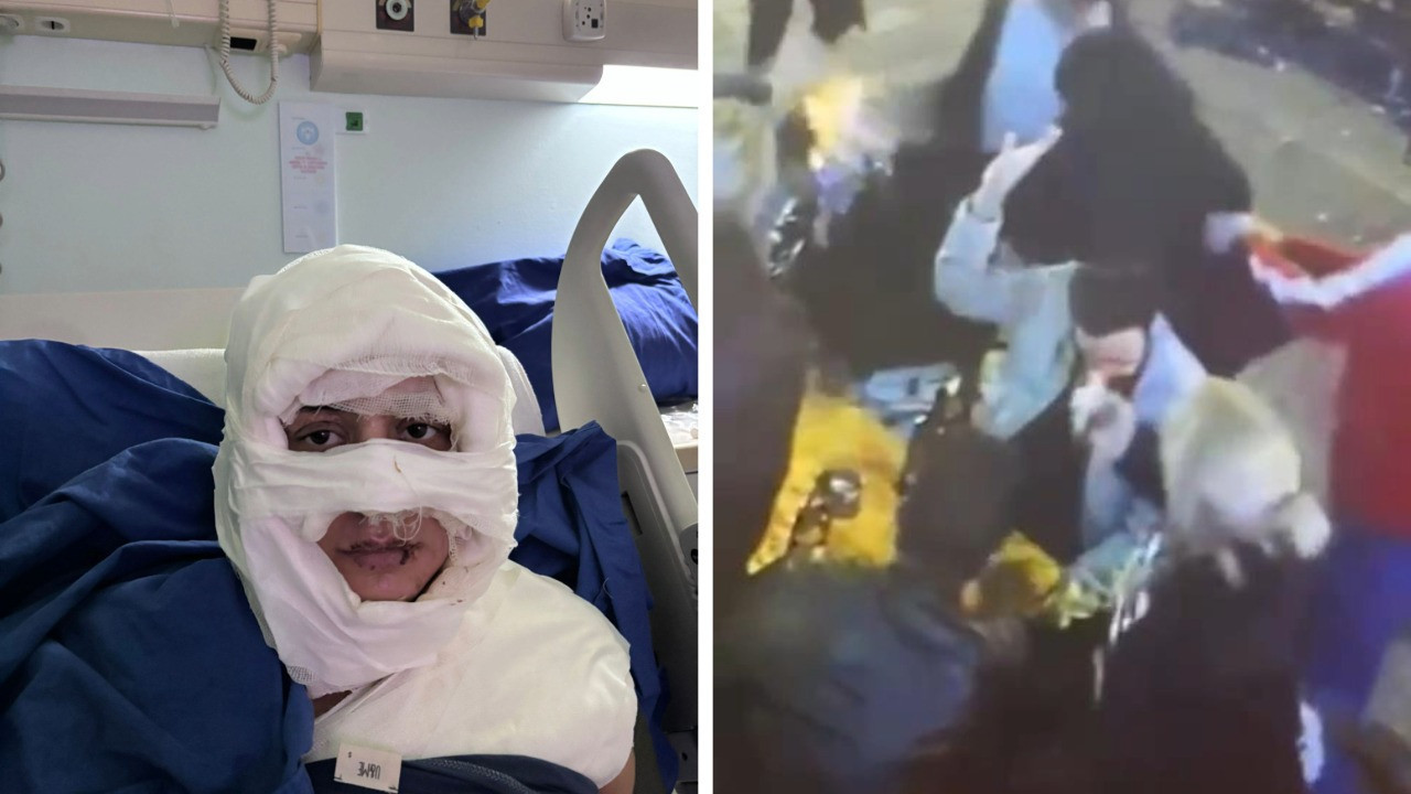 Kolonya döküp yakmıştı: Pişmanım