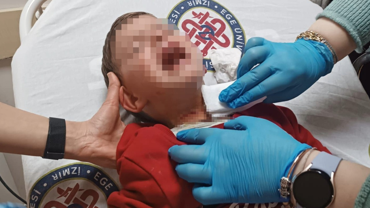 Parkta oynayan 2 yaşındaki çocuğa bıçaklı saldırı