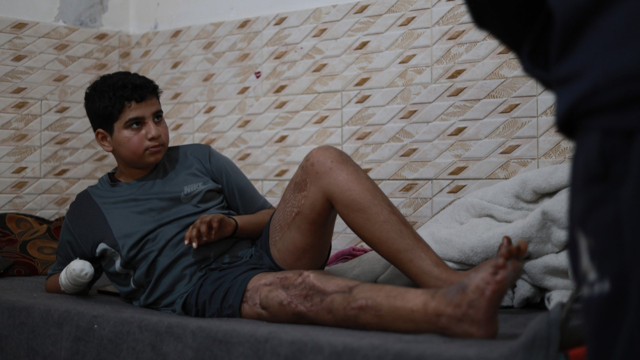 Futbol oynarken bulduğu mühimmatı eve götürdü, elini kaybetti