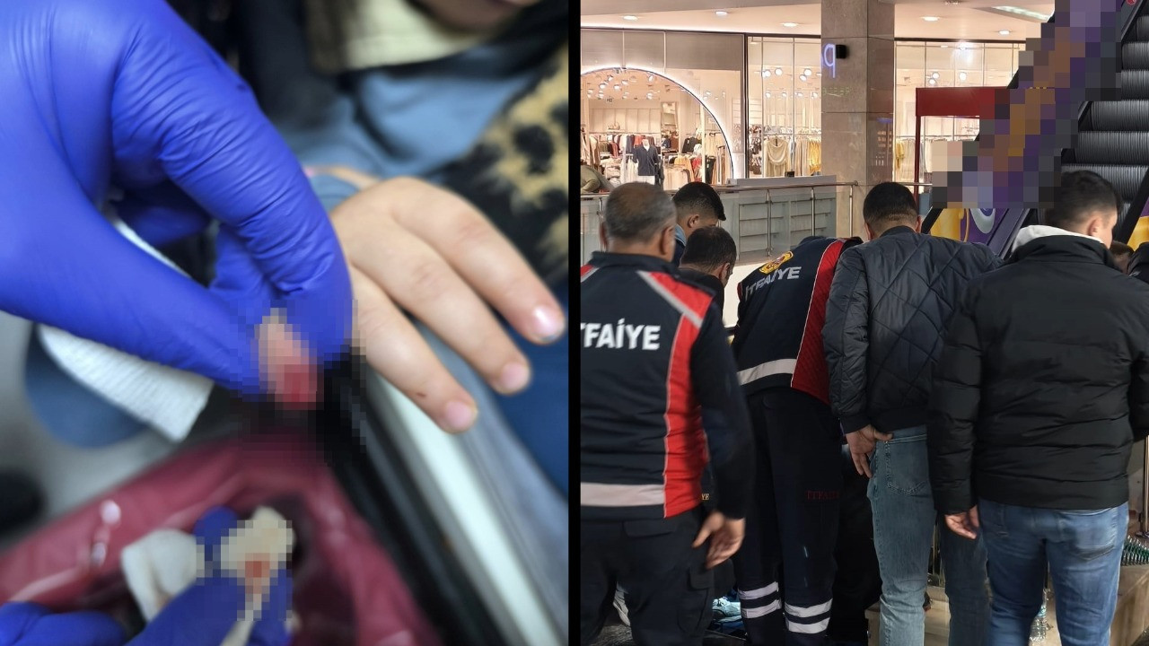 AVM merdiveninde parmağı koptu