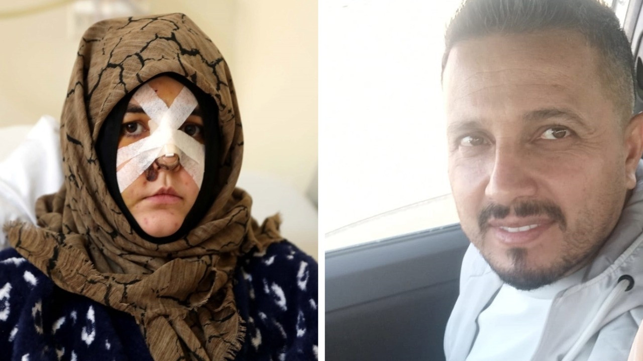 Boşanma aşamasındaki eşine vurduğu kaldırım taşı 'silah' sayıldı