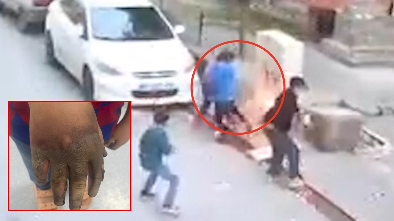 Elektrik panosu kabusu: Çocuğun eli kıvılcımlarla yandı