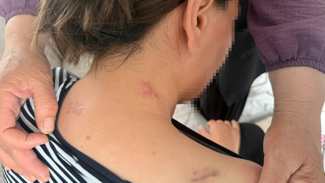 Eşi 17 yerinden bıçakladı: Kızımın çığlıkları kulaklarımda