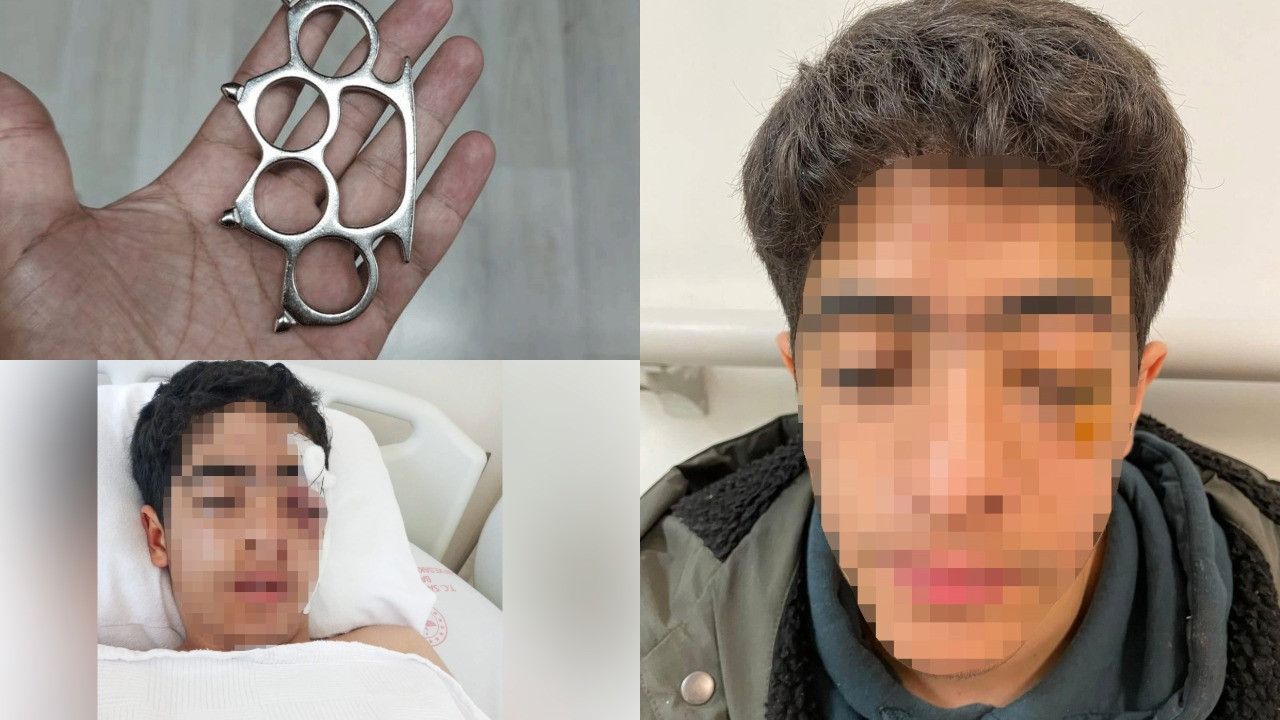 Akran zorbalığına bir yenisi eklendi: 15 yaşındaki çocuk muştayla öldüresiye dövüldü