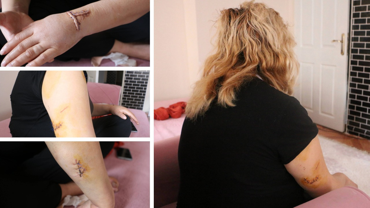 Eski sevgili dehşeti! Apartman girişinde pusu kusup 30 yerinden bıçakladı