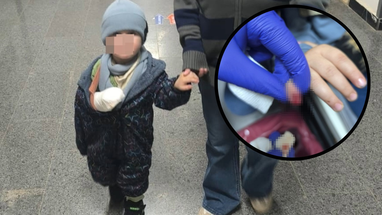 Yürüyen merdivene kaptırdığı parmağı kurtarılamadı