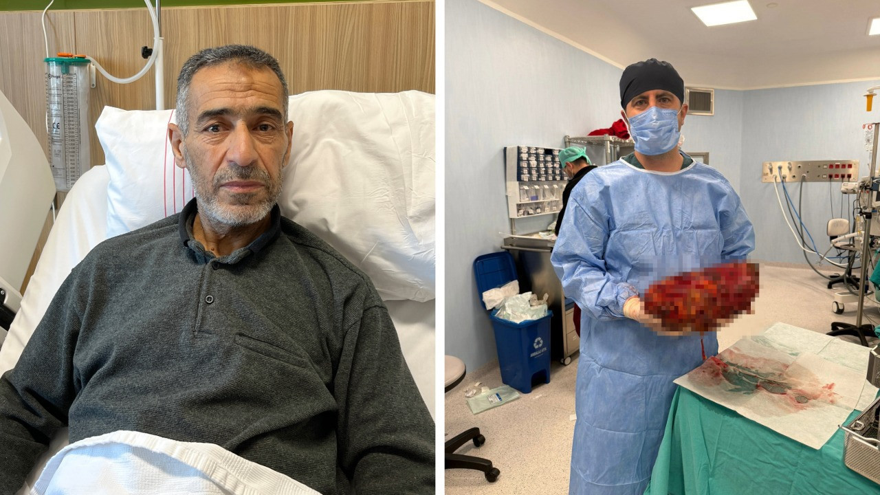 Karın ağrısı şikayetiyle gitti, karnından 8 kiloluk böbrek çıktı