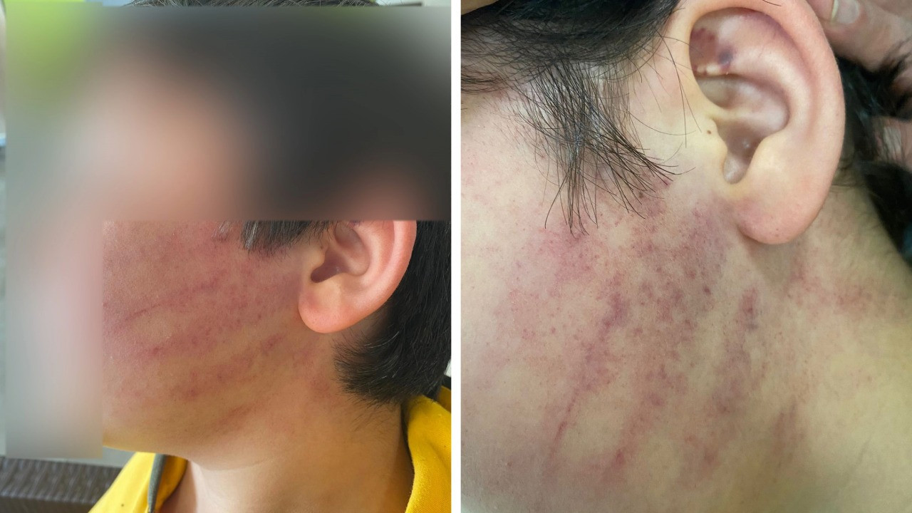 Okulu basan aile iki çocuğu dövdü