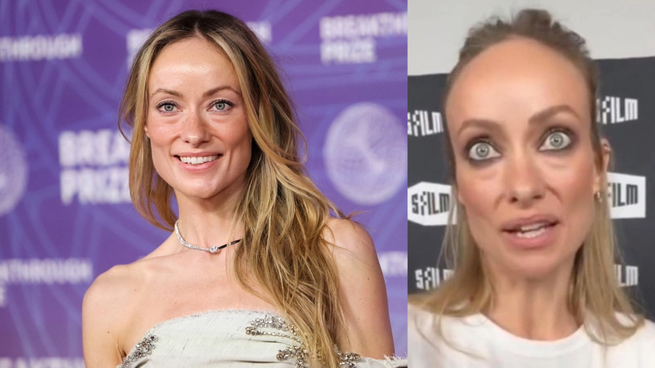 Gollum'a benzetilmişti: Ünlü oyuncu sessizliğini bozdu