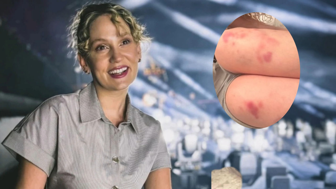 Farah Zeynep Abdullah’ın morlukları hayranlarını endişelendirdi