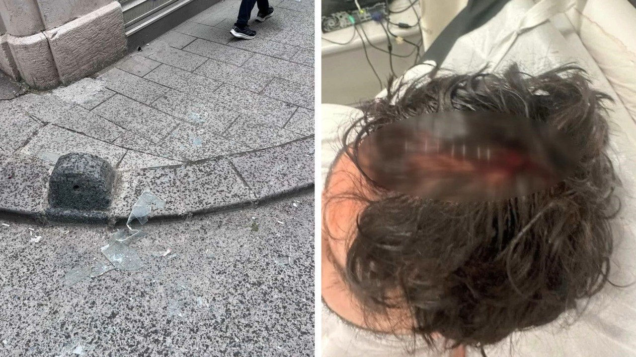 Beyoğlu’nda kaldırımda yürürken başına cam düştü, 7 dikiş atıldı