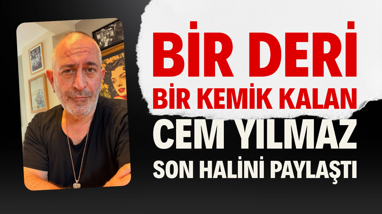 Bir deri bir kemik kalan Cem Yılmaz son halini paylaştı