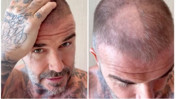 David Beckham'ın tıraş kazası: Kel kaldı, eşi alay etti