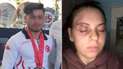'Telefonun sesini kıs' dedi, dayak yedi: Milli sporcu için şok iddia