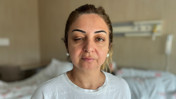G&uuml;zellik salonunda botoks faciası! &Ouml;l&uuml;mden d&ouml;nd&uuml;ler