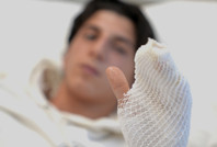 Yanlış buz uygulaması yüzünden az kalsın parmağı kesilecekti