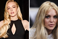 Lindsay Lohan’ın değişimi estetik cerrahı da şaşırttı