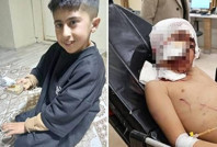 10 yaşındaki Murat, köpeklerin saldırısında yaralandı