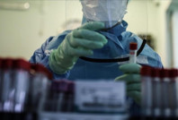 Fare dışkısından bulaşıyor: Lassa ateşi 151 can aldı