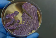 Melioidoz salgınında 20 kişi öldü