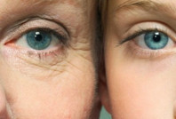 Cilt kırışıklıkları nasıl önlenir? Ünlü dermatolog tek tek açıkladı