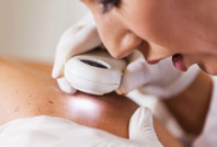 Vücuttaki her leke masum olmayabilir: Uzmanlar uyardı, 'ABCDE' kuralına dikkat