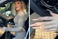 Popüler zayıflama ilaçlarının görünmeyen yüzü: 'Ozempic eller'