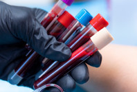 Bilim dünyası şokta: Yeni bir kan grubu keşfedildi