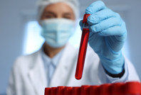 Hollanda'da tüm vatandaşların kanında zehir çıktı