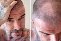 David Beckham'ın tıraş kazası: Kel kaldı, eşi alay etti