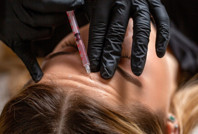 Botoks kâbusa dönüştü: Felç kaldı, 1 milyon TL harcadı