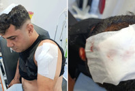 İş görüşmesine gitti, ölümden döndü